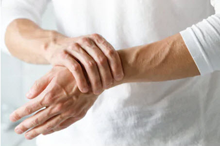 Arthritis Arthritis